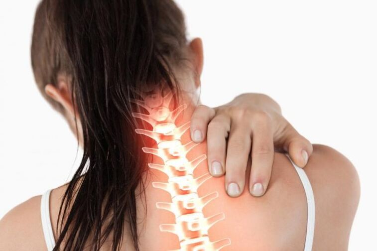 Nackenschmerzen sind ein Symptom der Osteochondrose der Halswirbelsäule. 