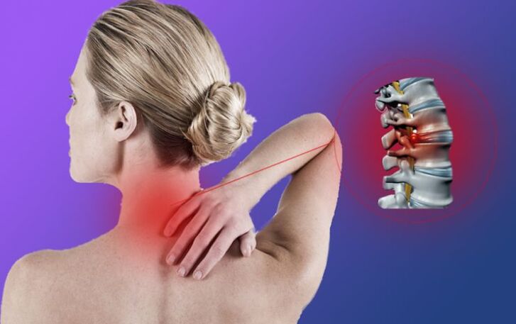 Osteochondrose der Halswirbelsäule führt zur Entwicklung von Zwischenwirbelhernien. 