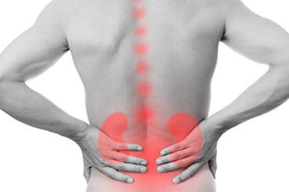 Nierenerkrankungen können das Auftreten von Rückenschmerzen verursachen