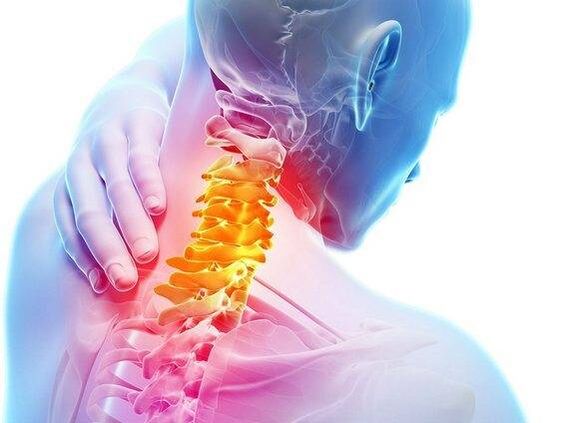 Osteochondrose