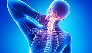 Symptome und Behandlung der Hals -Osteochondrose