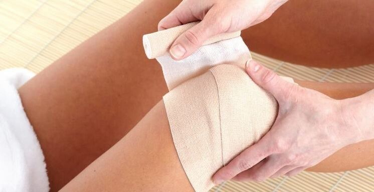 Kompresse am Knie bei Arthritis und Arthrose.
